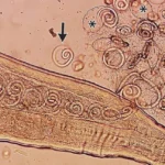 The Parasitic Passenger: Inside the Complex Life Cycle of Thelazia callipaeda